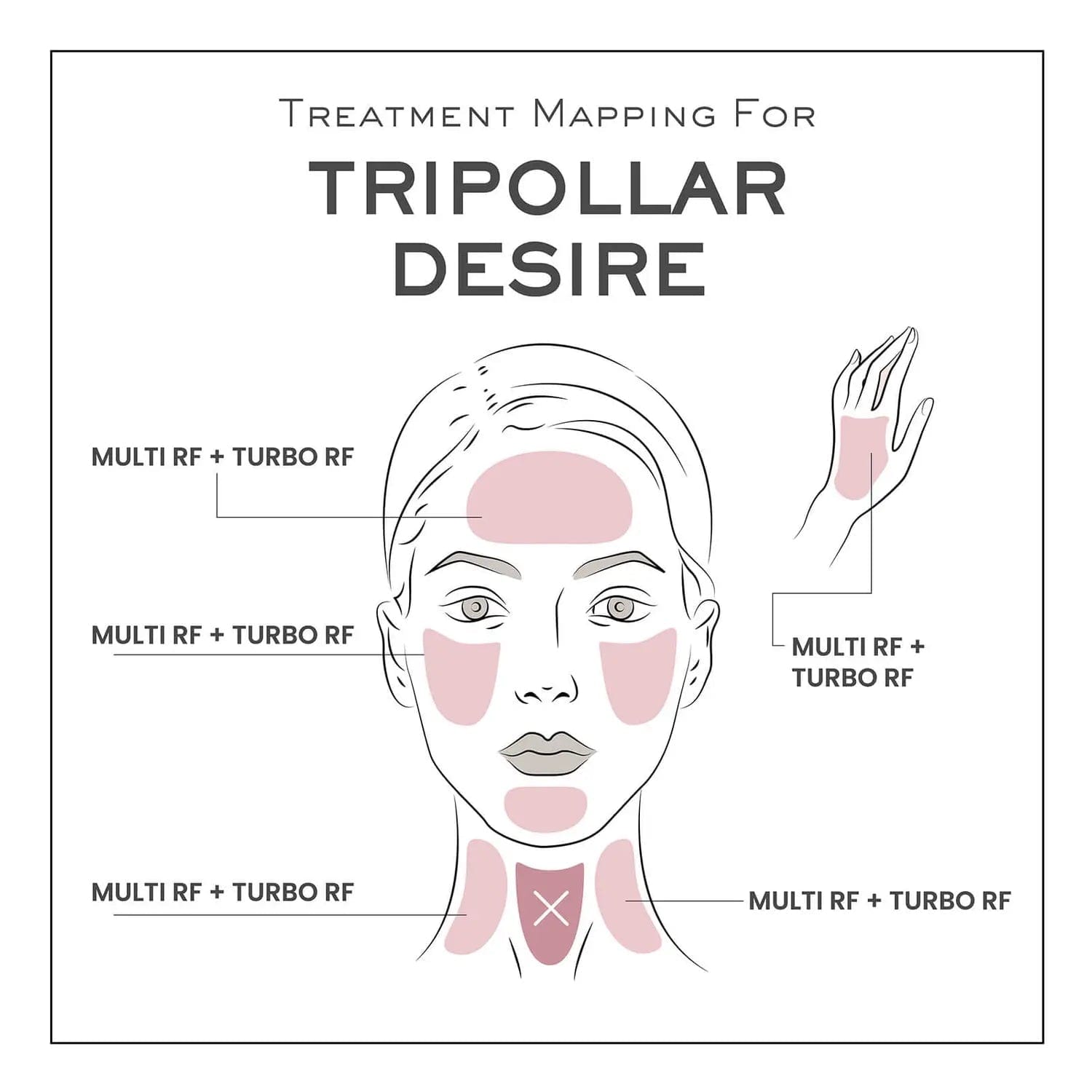 TRIPOLLAR DESIRE 面部射頻機 香港行貨